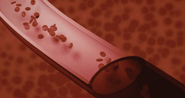 Thrombolysis for Deep Vein Thrombosis