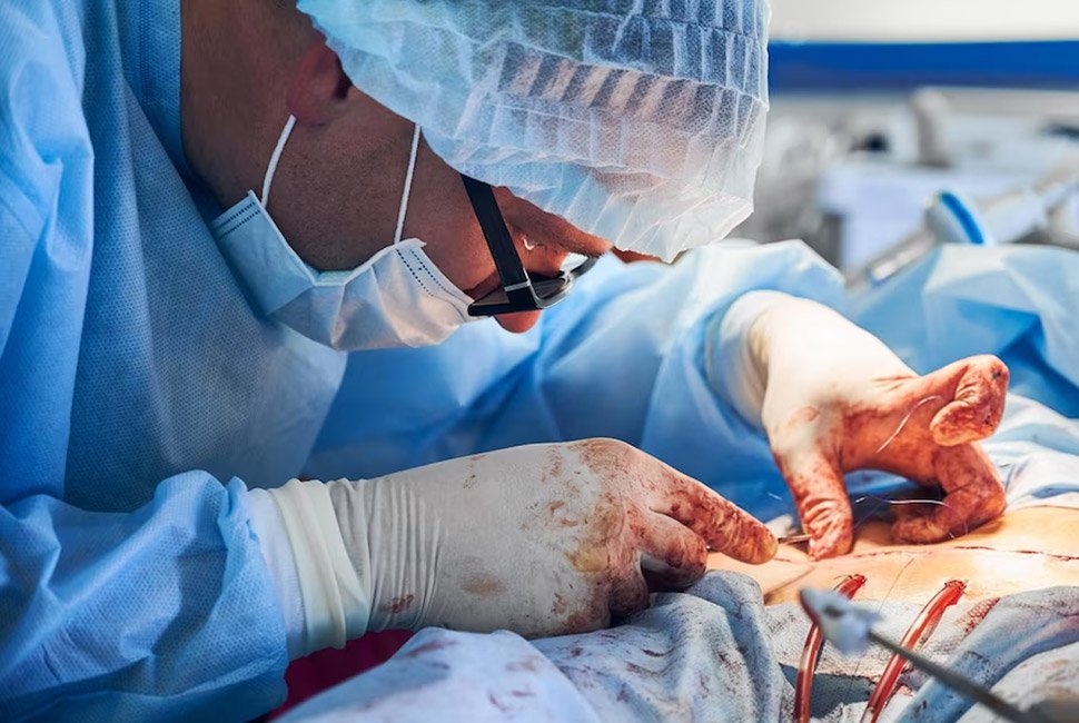 Bypass Surgery for Peripheral Artery Disease