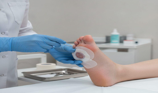 Advanced wound care for diabetic foot