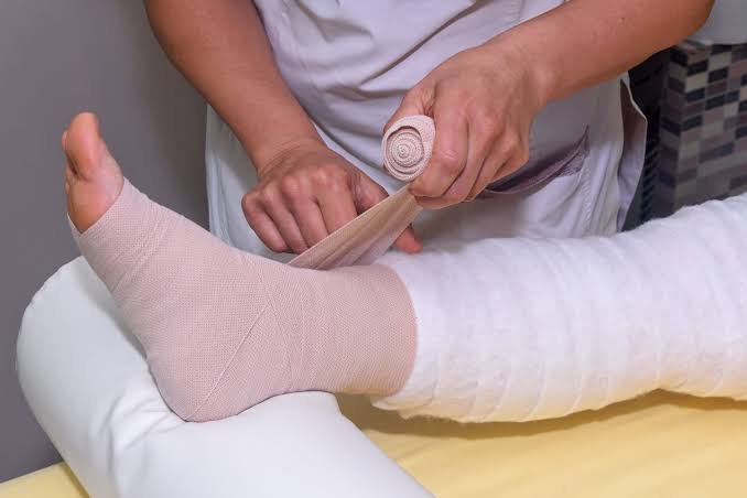 Compression Therapy for Deep Vein Thrombosis